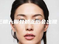 三明大脚骨矫正后会出现什么副作用呢
