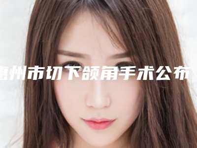 惠州市切下颌角手术公布2025价目表(12月-5月均价为:37887元)