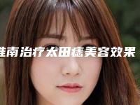 淮南治疗太田痣美容效果好不好